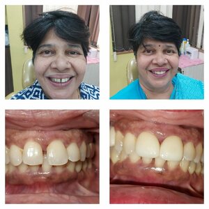 Dr. Reena Vora Patient Success Story